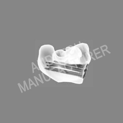 Distal Fermoral Condyle Sperrplack Foto 2