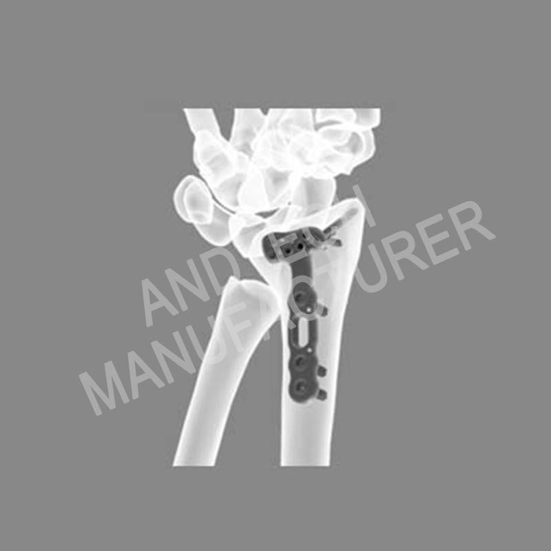 Distal-Radius-Volar-Titiipa-Plates-III01