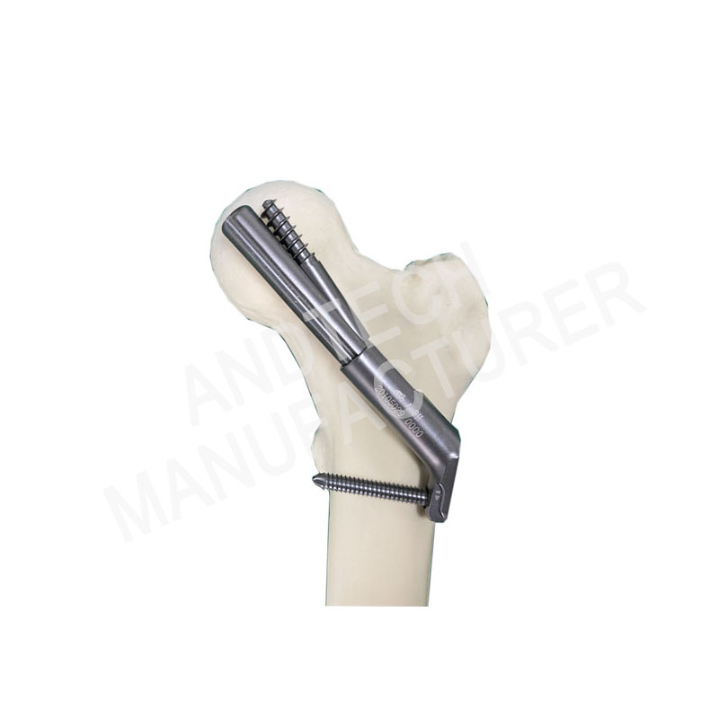 FNS (Femoral Neck System)