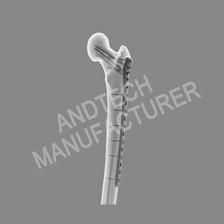 Proximal Femoral Sperrplack IV01