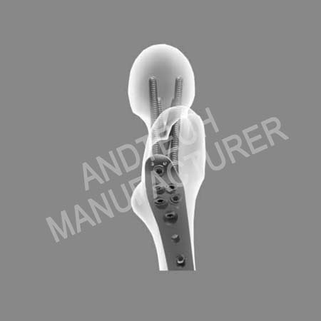 Placa de bloqueig femoral proximal IV02