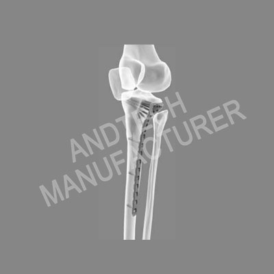 Proximal Tibia Lateral Locking Plate IV larawan1