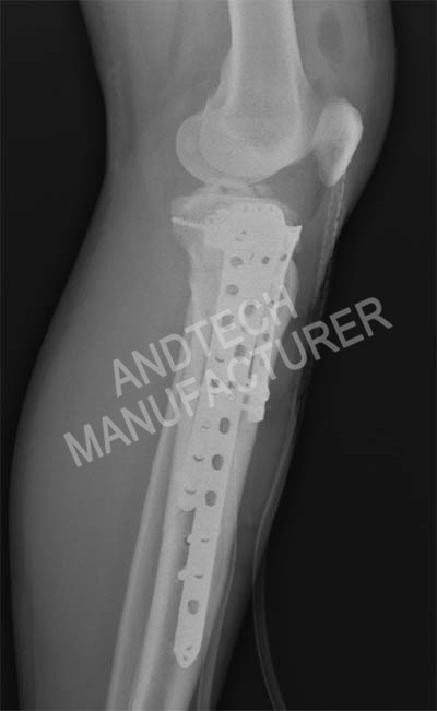 Proximal-Tibia၆