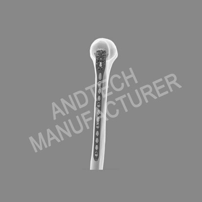 Shoulder Joint at Humerus Locking Plate System11