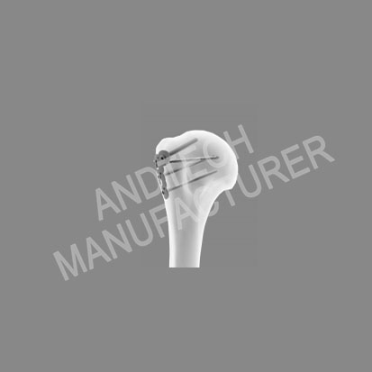 Shoulder Joint at Humerus Locking Plate System9