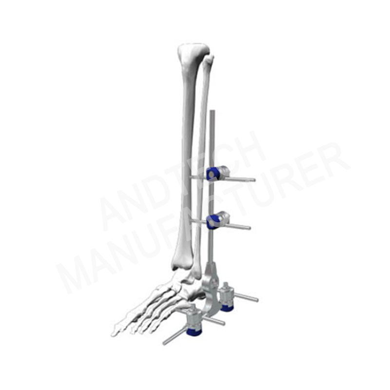 Ankle Joint Fixation 8mm